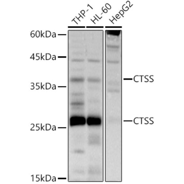 Western Blot - Anti-Cathepsin S Antibody (A11488) - Antibodies.com