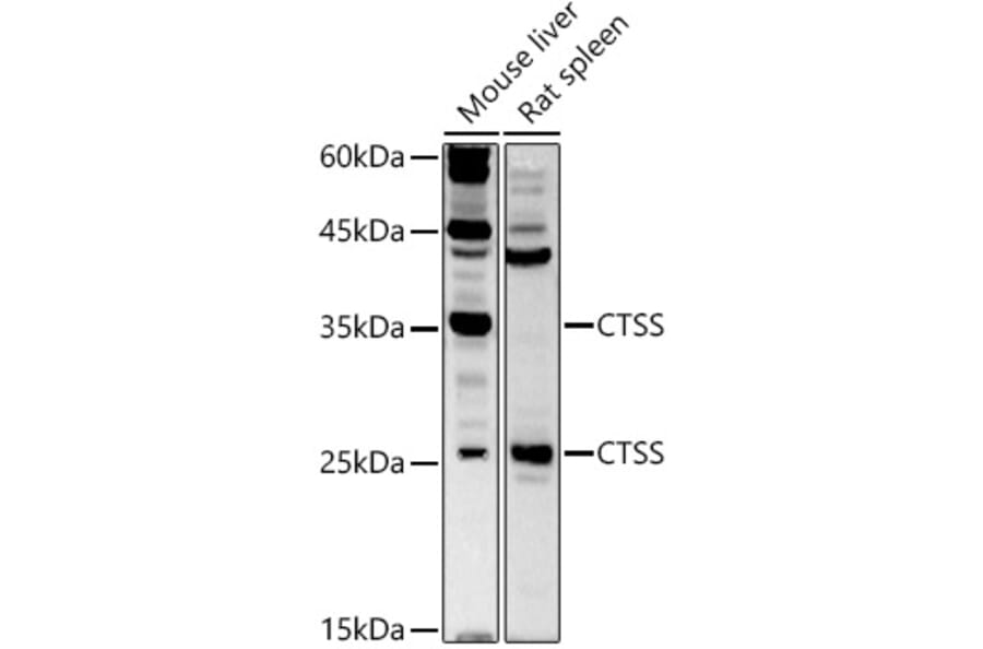 Western Blot - Anti-Cathepsin S Antibody (A11488) - Antibodies.com