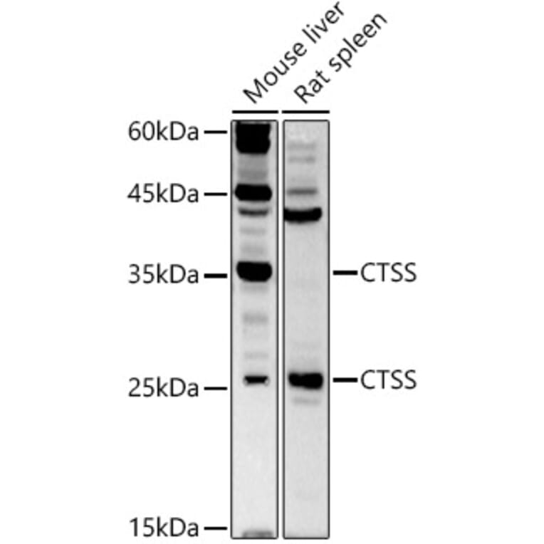 Western Blot - Anti-Cathepsin S Antibody (A11488) - Antibodies.com