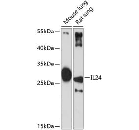 Western Blot - Anti-IL-24 Antibody (A11489) - Antibodies.com