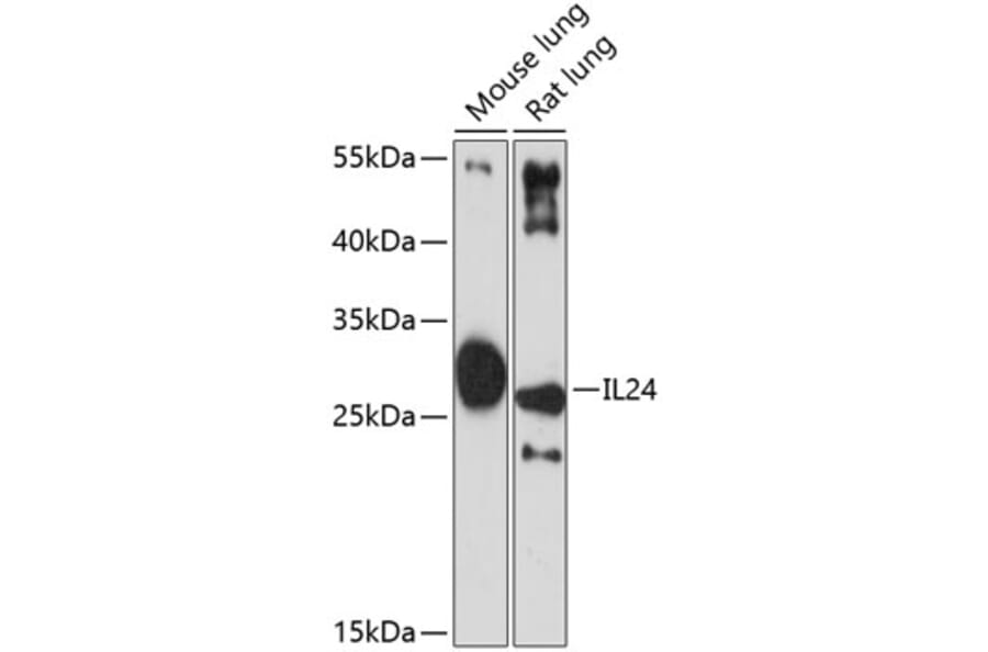 Western Blot - Anti-IL-24 Antibody (A11489) - Antibodies.com