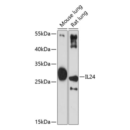 Western Blot - Anti-IL-24 Antibody (A11489) - Antibodies.com