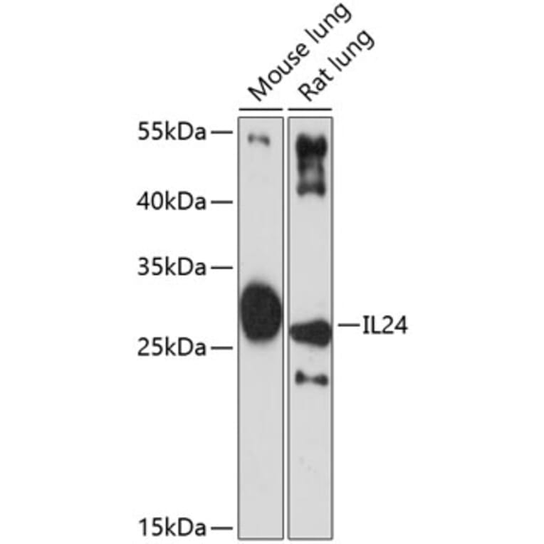 Western Blot - Anti-IL-24 Antibody (A11489) - Antibodies.com