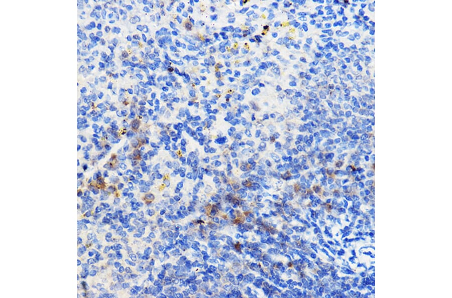 Immunohistochemistry - Anti-IL-24 Antibody (A11489) - Antibodies.com