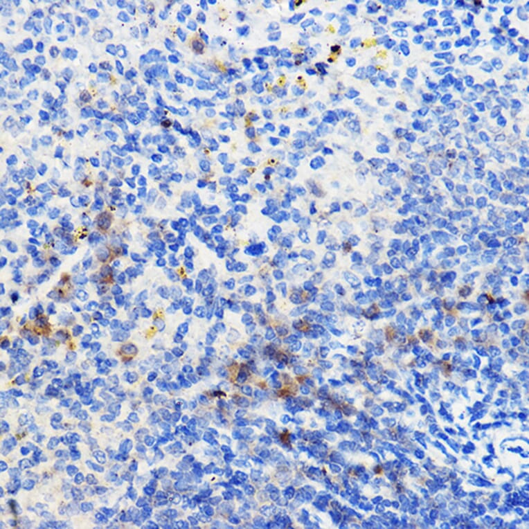Immunohistochemistry - Anti-IL-24 Antibody (A11489) - Antibodies.com
