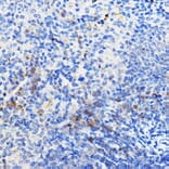Immunohistochemistry - Anti-IL-24 Antibody (A11489) - Antibodies.com
