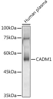 Western blot analysis of extracts of various cell lines, using Anti-CADM1 Antibody (A1892) at 1:1,000 dilution.
Secondary antibody: Goat Anti-Rabbit IgG (H+L) (HRP) (AS014) at 1:10,000 dilution.
Lysates / proteins: 25µg per lane.
Blocking buffer: 3% non-fat dry milk in TBST.