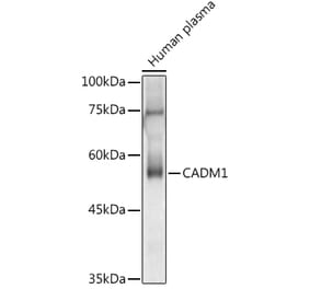 Western Blot - Anti-SynCAM/CADM1 Antibody (A11490) - Antibodies.com