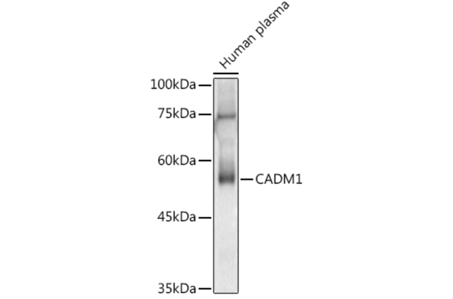 Western Blot - Anti-SynCAM/CADM1 Antibody (A11490) - Antibodies.com