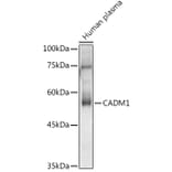 Western Blot - Anti-SynCAM/CADM1 Antibody (A11490) - Antibodies.com