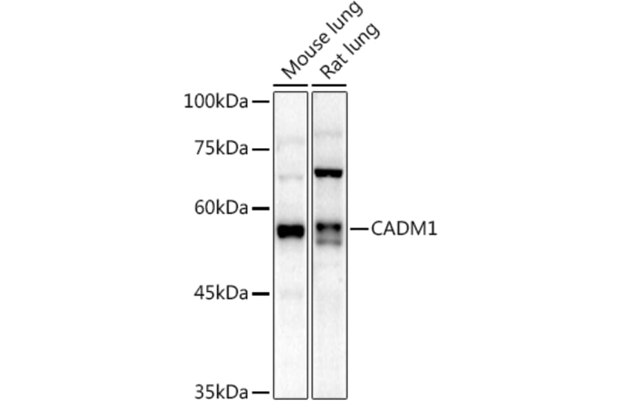 Western Blot - Anti-SynCAM/CADM1 Antibody (A11490) - Antibodies.com