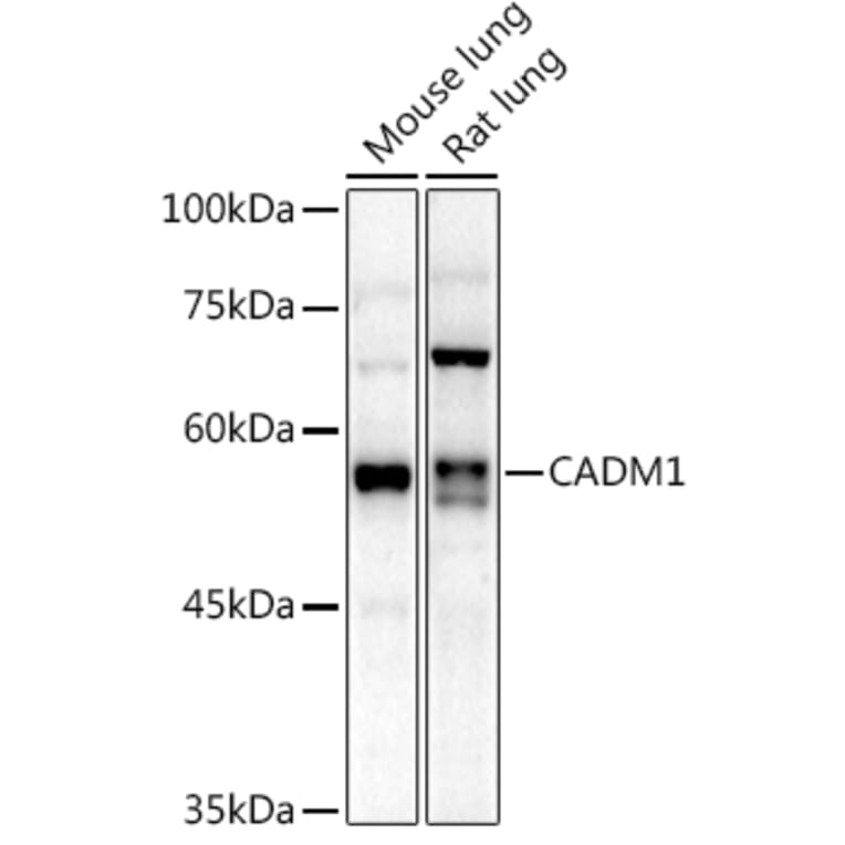 Western Blot - Anti-SynCAM/CADM1 Antibody (A11490) - Antibodies.com