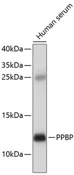 Western blot analysis of extracts of human serum, using Anti-PPBP Antibody (A1925) at 1:1,000 dilution.
Secondary antibody: Goat Anti-Rabbit IgG (H+L) (HRP) (AS014) at 1:10,000 dilution.
Lysates / proteins: 25µg per lane.
Blocking buffer: 3% non-fat dry milk in TBST.
Detection: ECL Basic Kit (RM00020).
Exposure time: 5min.