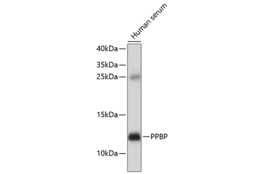 Western Blot - Anti-CXCL7/PBP Antibody (A11491) - Antibodies.com