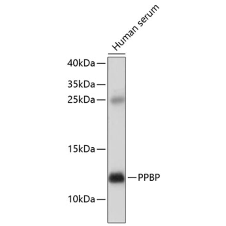 Western Blot - Anti-CXCL7/PBP Antibody (A11491) - Antibodies.com