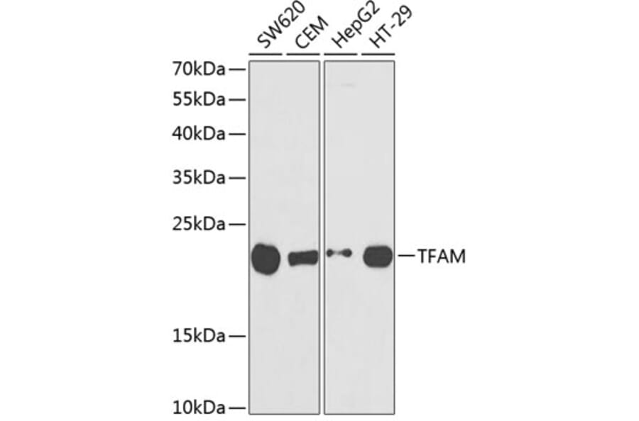 Western Blot - Anti-mtTFA Antibody (A11492) - Antibodies.com