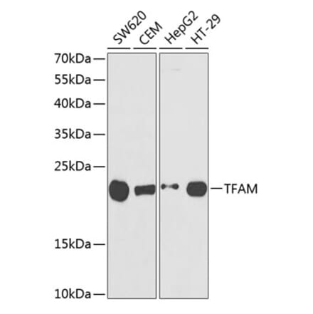 Western Blot - Anti-mtTFA Antibody (A11492) - Antibodies.com