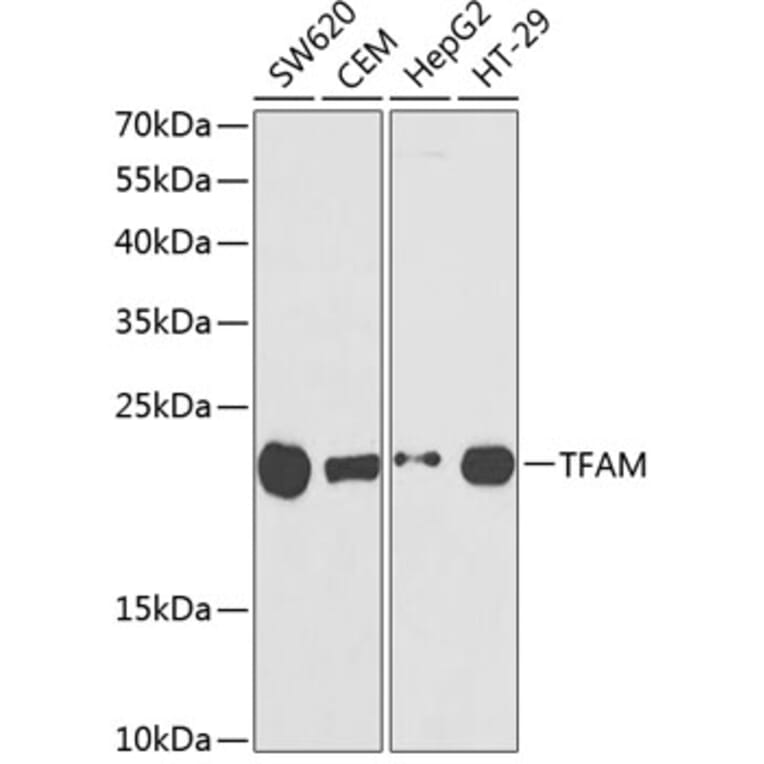 Western Blot - Anti-mtTFA Antibody (A11492) - Antibodies.com