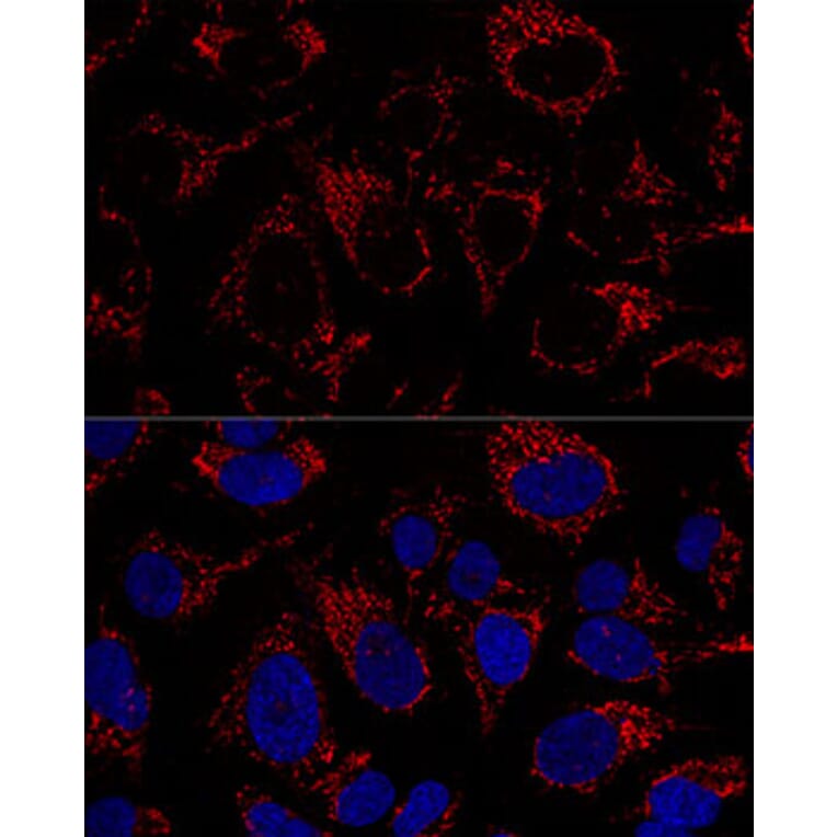 Immunofluorescence - Anti-mtTFA Antibody (A11492) - Antibodies.com