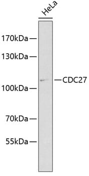 Western blot analysis of extracts of HeLa cells, using Anti-CDC27 Antibody (A1954) at 1:1,000 dilution.
Secondary antibody: Goat Anti-Rabbit IgG (H+L) (HRP) (AS014) at 1:10,000 dilution.
Lysates / proteins: 25µg per lane.
Blocking buffer: 3% non-fat dry milk in TBST.
Detection: ECL Enhanced Kit (RM00021).