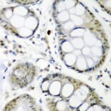 Immunohistochemistry - Anti-Cdc27 Antibody (A11494) - Antibodies.com