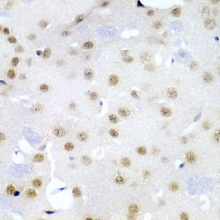 Immunohistochemistry - Anti-Cdc27 Antibody (A11494) - Antibodies.com