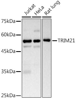 Western blot analysis of extracts of various cell lines, using Anti-TRIM21 Antibody (A1957) at 1:1,000 dilution.
Secondary antibody: Goat Anti-Rabbit IgG (H+L) (HRP) (AS014) at 1:10,000 dilution.
Lysates / proteins: 25µg per lane.
Blocking buffer: 3% non-fat dry milk in TBST.