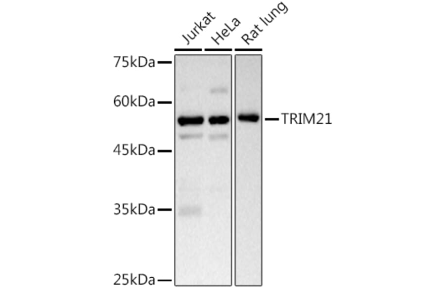 Western Blot - Anti-TRIM21/SS-A Antibody (A11495) - Antibodies.com