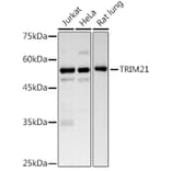 Western Blot - Anti-TRIM21/SS-A Antibody (A11495) - Antibodies.com