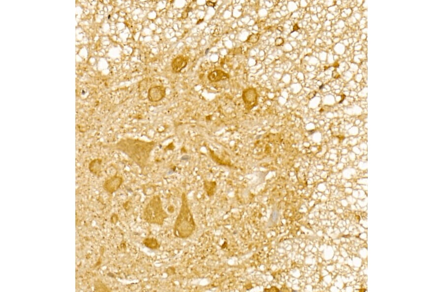 Immunohistochemistry - Anti-TRIM21/SS-A Antibody (A11495) - Antibodies.com