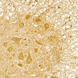 Immunohistochemistry - Anti-TRIM21/SS-A Antibody (A11495) - Antibodies.com
