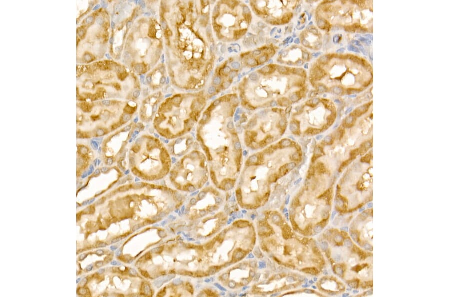 Immunohistochemistry - Anti-TRIM21/SS-A Antibody (A11495) - Antibodies.com