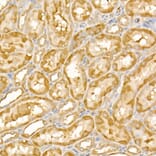 Immunohistochemistry - Anti-TRIM21/SS-A Antibody (A11495) - Antibodies.com