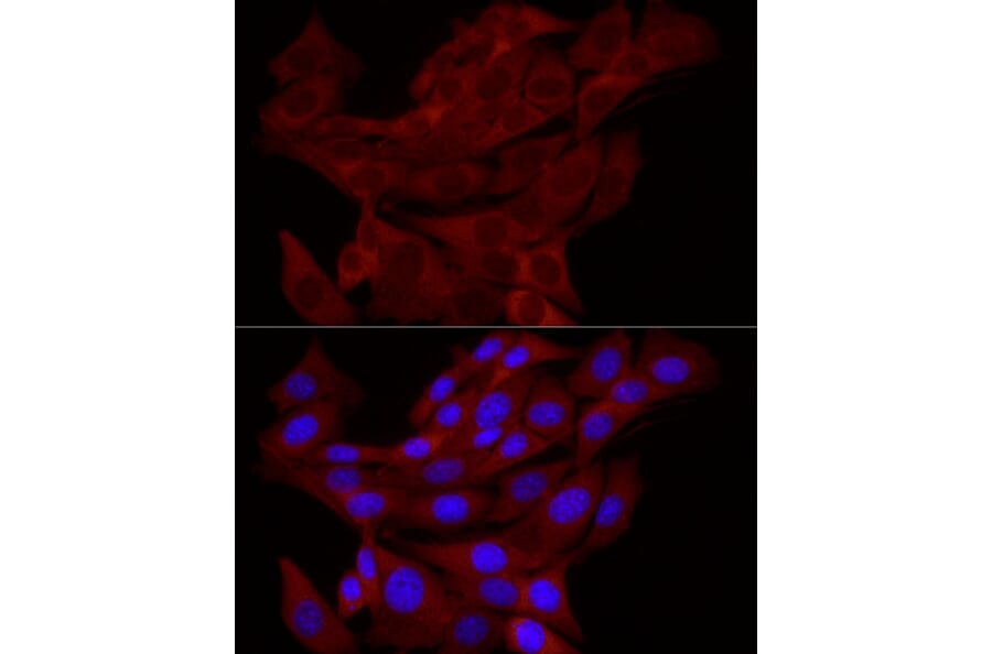Immunofluorescence - Anti-TRIM21/SS-A Antibody (A11495) - Antibodies.com