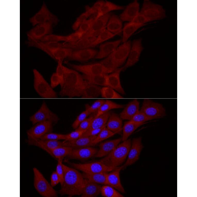 Immunofluorescence - Anti-TRIM21/SS-A Antibody (A11495) - Antibodies.com