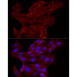 Immunofluorescence - Anti-TRIM21/SS-A Antibody (A11495) - Antibodies.com