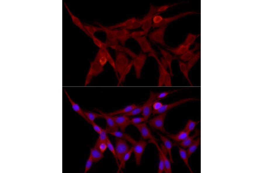 Immunofluorescence - Anti-TRIM21/SS-A Antibody (A11495) - Antibodies.com