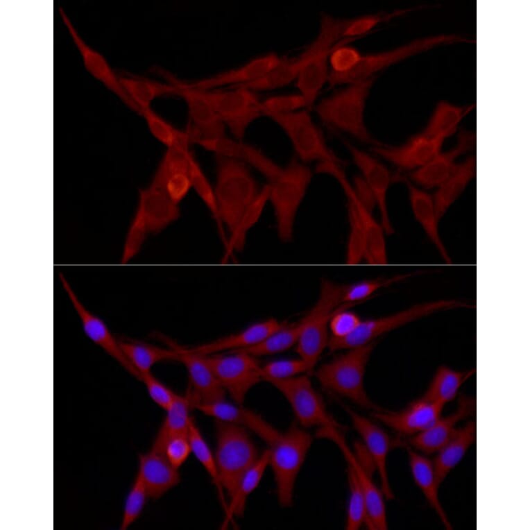 Immunofluorescence - Anti-TRIM21/SS-A Antibody (A11495) - Antibodies.com