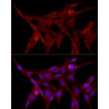 Immunofluorescence - Anti-TRIM21/SS-A Antibody (A11495) - Antibodies.com
