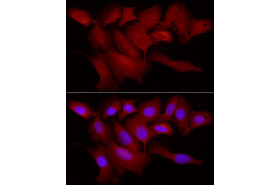 Immunofluorescence - Anti-TRIM21/SS-A Antibody (A11495) - Antibodies.com