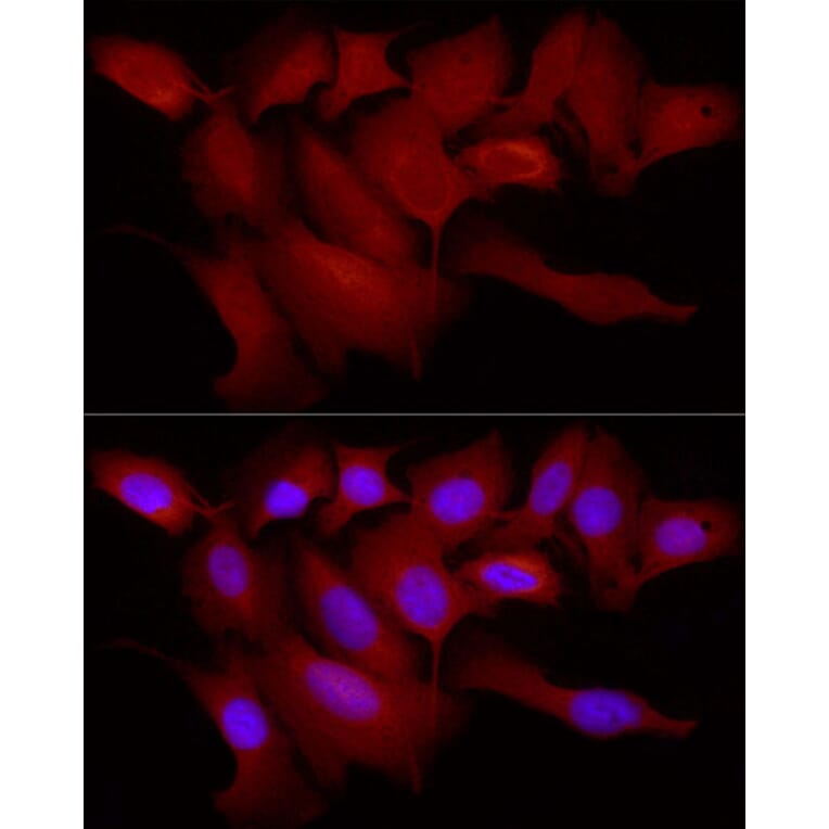 Immunofluorescence - Anti-TRIM21/SS-A Antibody (A11495) - Antibodies.com