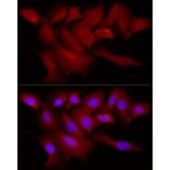Immunofluorescence - Anti-TRIM21/SS-A Antibody (A11495) - Antibodies.com