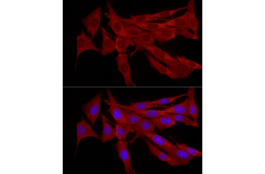 Immunofluorescence - Anti-TRIM21/SS-A Antibody (A11495) - Antibodies.com