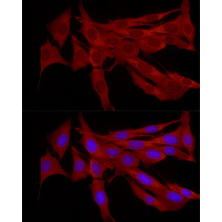 Immunofluorescence - Anti-TRIM21/SS-A Antibody (A11495) - Antibodies.com