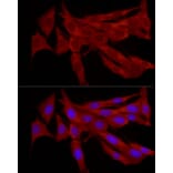 Immunofluorescence - Anti-TRIM21/SS-A Antibody (A11495) - Antibodies.com