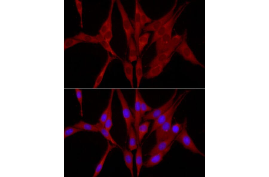 Immunofluorescence - Anti-TRIM21/SS-A Antibody (A11495) - Antibodies.com