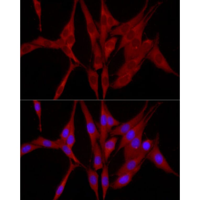 Immunofluorescence - Anti-TRIM21/SS-A Antibody (A11495) - Antibodies.com