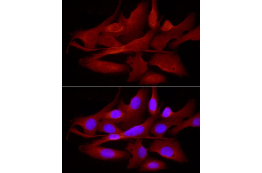 Immunofluorescence - Anti-TRIM21/SS-A Antibody (A11495) - Antibodies.com