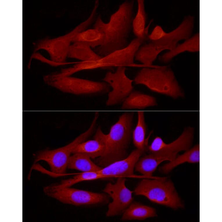 Immunofluorescence - Anti-TRIM21/SS-A Antibody (A11495) - Antibodies.com