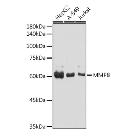 Western Blot - Anti-MMP8 Antibody (A11496) - Antibodies.com